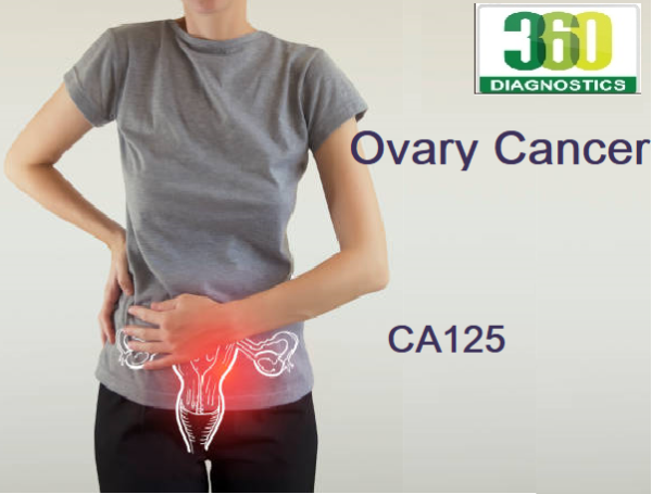 CA 125 (Ovarian Cancer Marker) Serum